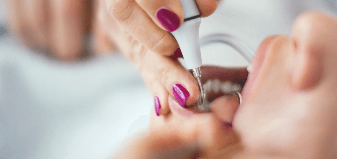 Coroa de porcelana: Quando é necessário reconstruir o dente?