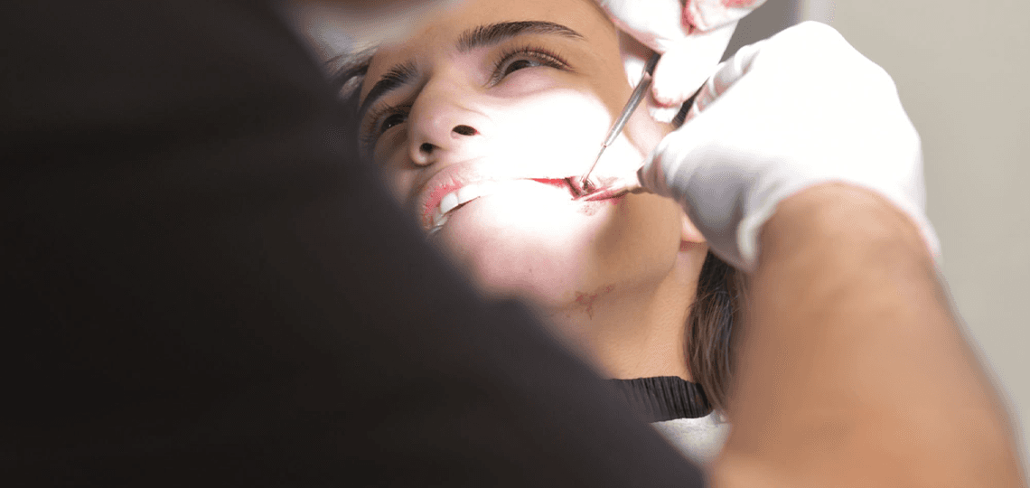 Gengivoplastia: A cirurgia para corrigir o sorriso gengival.