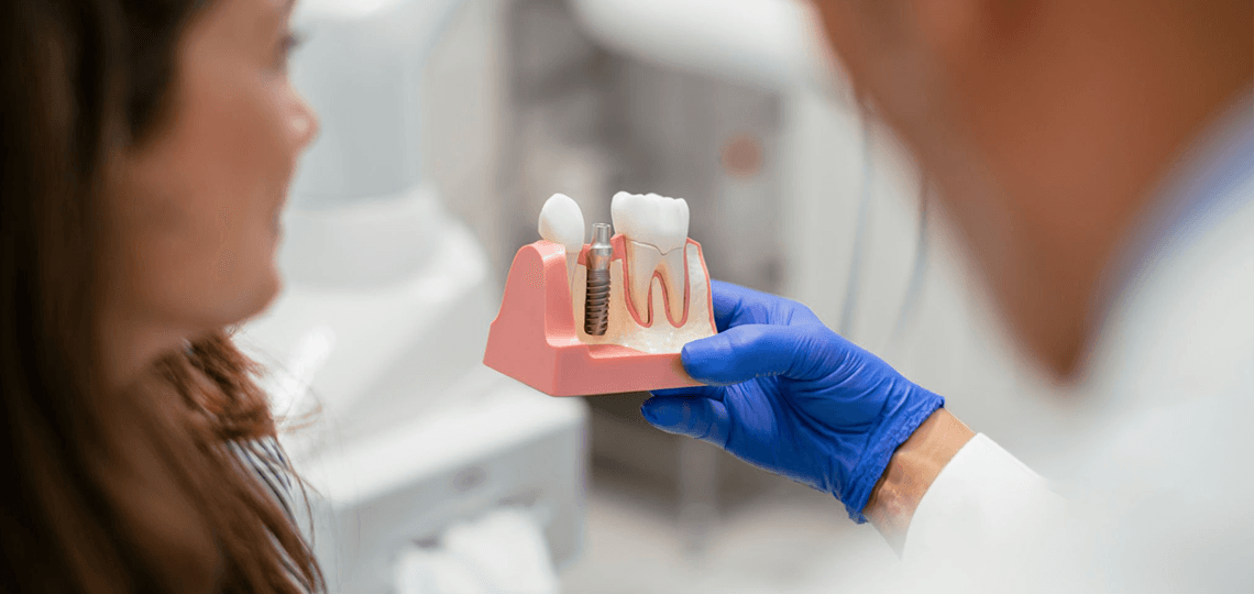 Mitos e verdades: Afinal, colocar implante dentário dói?
