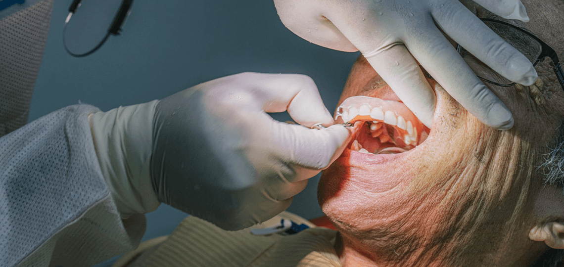 Odontogeriatria: Por que os idosos precisam de cuidados especiais?