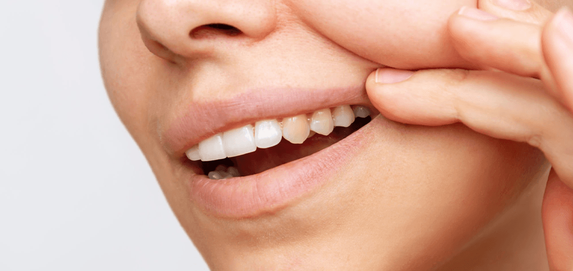 Por que os dentes ficam amarelos com o passar dos anos?