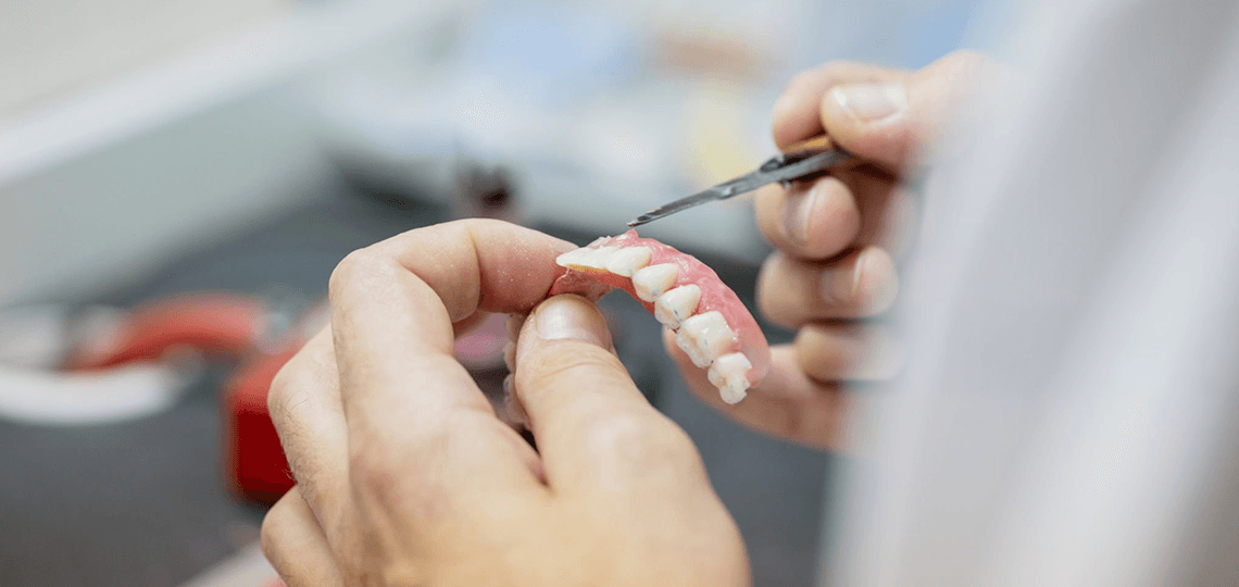 Prótese Protocolo: A solução fixa para quem perdeu todos os dentes.
