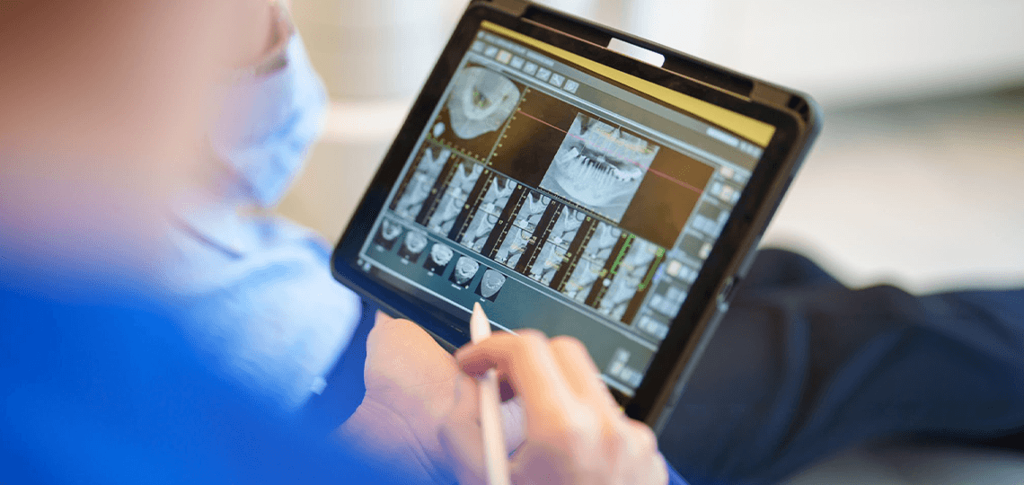 Tecnologia na endodontia: As vantagens do tratamento de canal moderno.